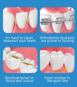 Cuatro recuadros con dientes y encías que muestran restos entre las piezas y brackets de ortodoncia